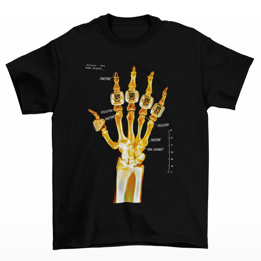 Kobe Bryant Hand X-ray T-Shirt